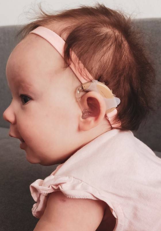 EasyFlex ULTRA headband for hearing aids and / or audio processor