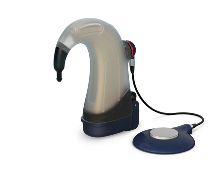 Kit de natation avec bobine / antenne SD pour processeur Oticon Medical Neuro 2 (force de l’aimant 1)